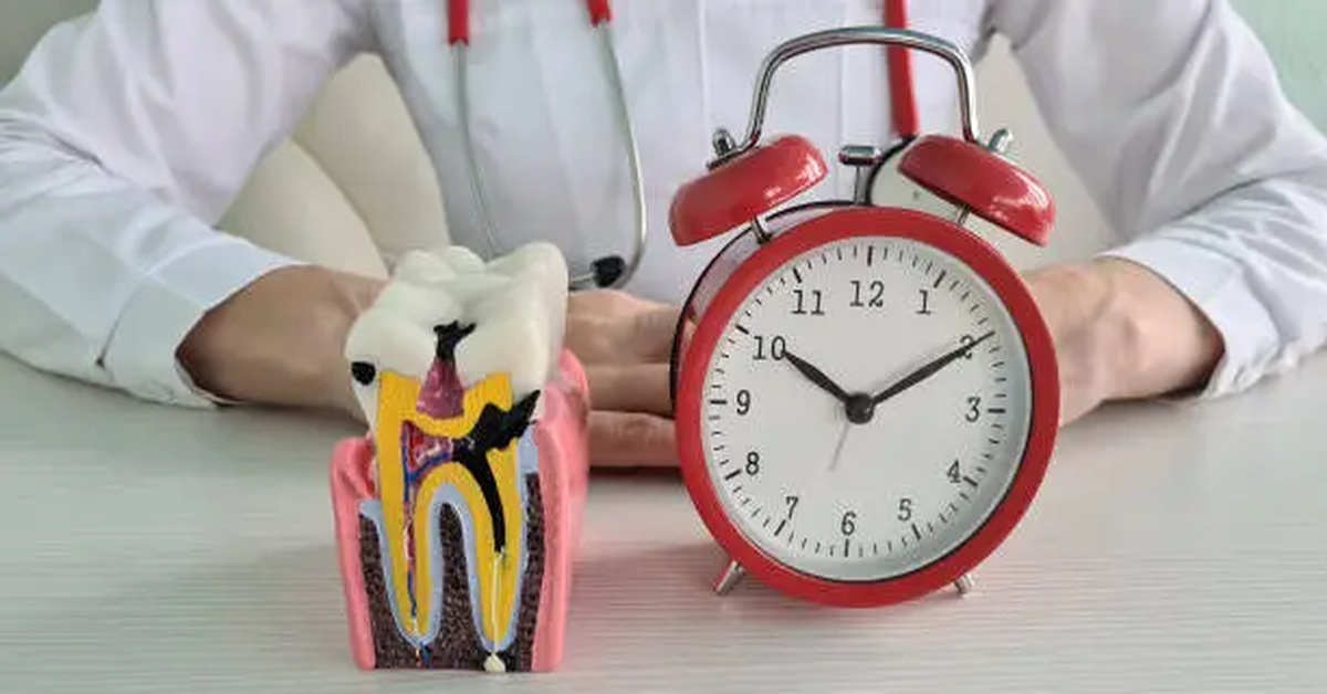 How Long Does a Root Canal Take